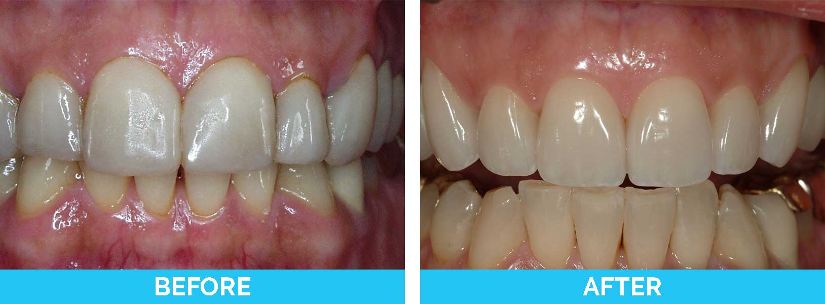 Before & After